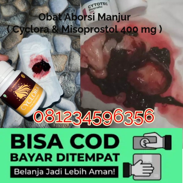 Obat Penggugur Kandungan Cyclora dan Cytotec Rekomendasi Dokter SpOG