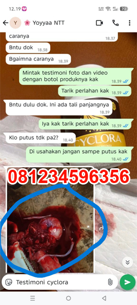 obat-penggugur-kandungan-cyclora-dan-cytotec-400-mg-untuk-kehamilan-5-6-7-8-minggu-2-bulan.jpg